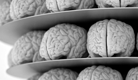 brains on shelf